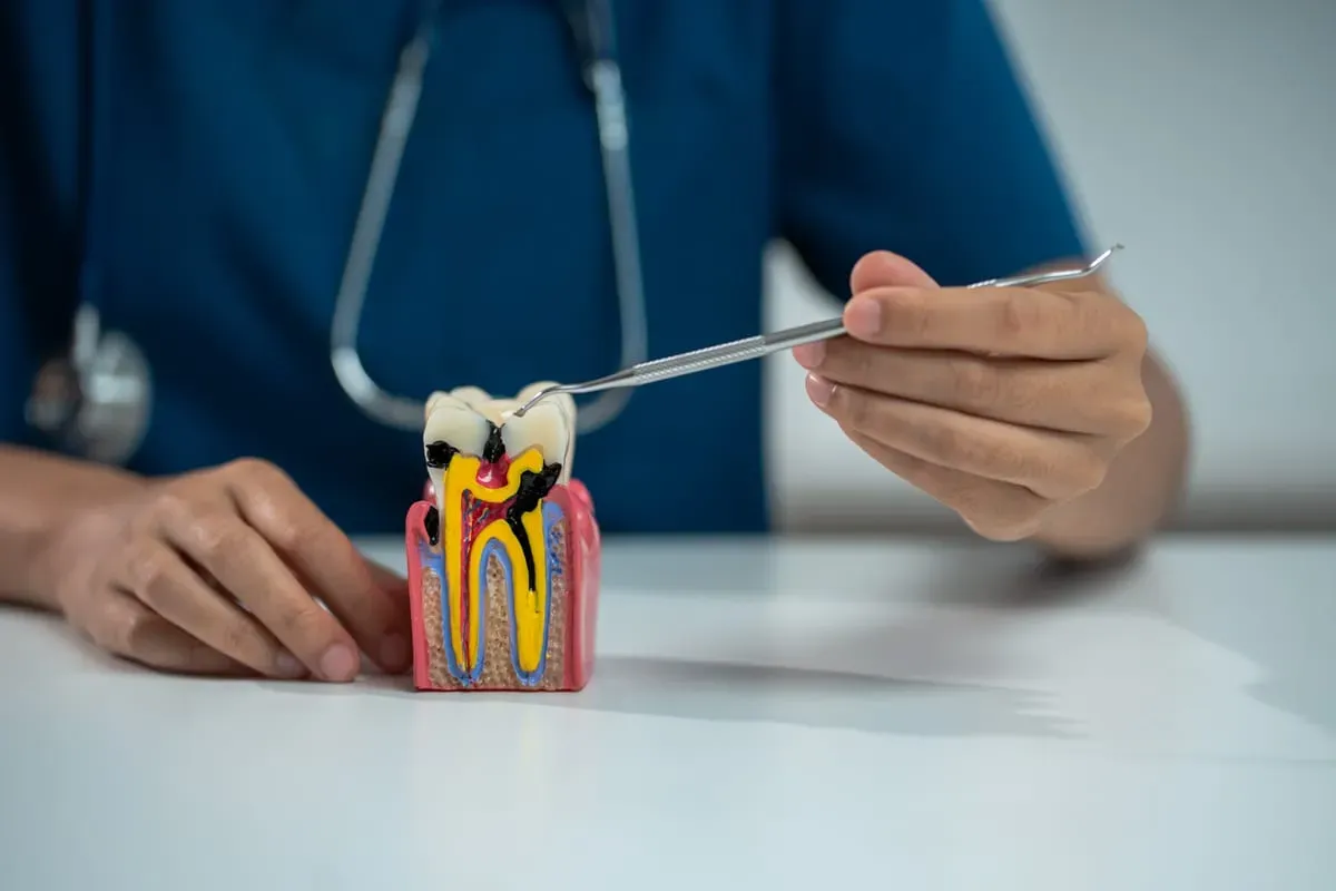 Root Canal Therapy: What to Expect and Why It Helps