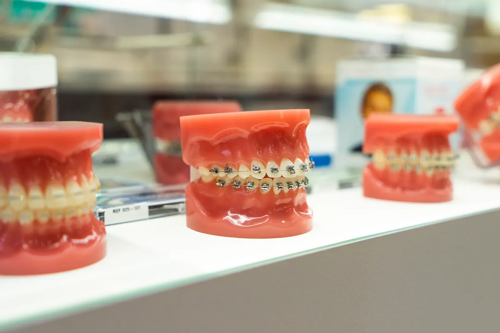 Braces at In Smyle Dental